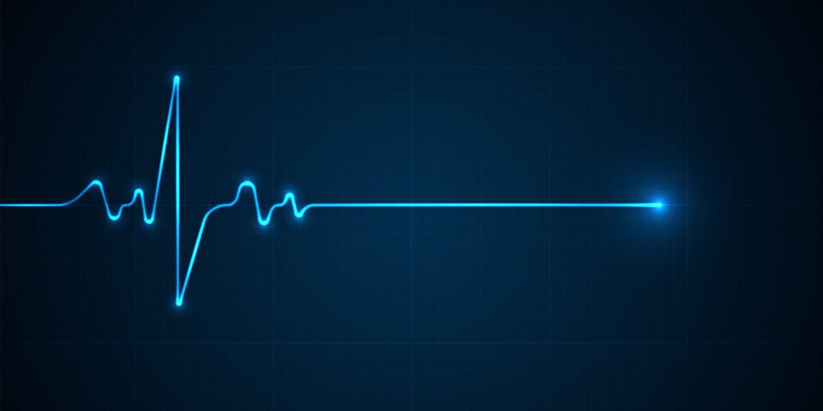 ECG heartbeat line