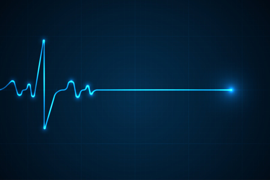 ECG heartbeat line